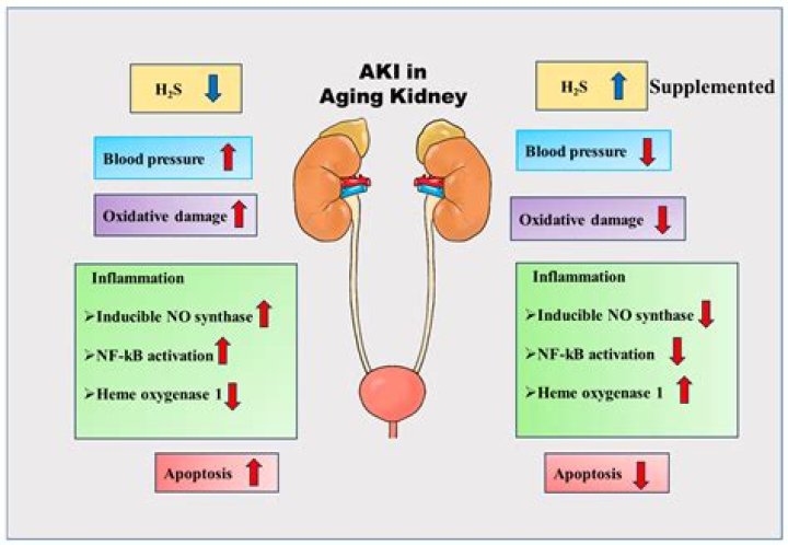 A Comprehensive Guide to "aki-h": Understanding Its Significance and Impact