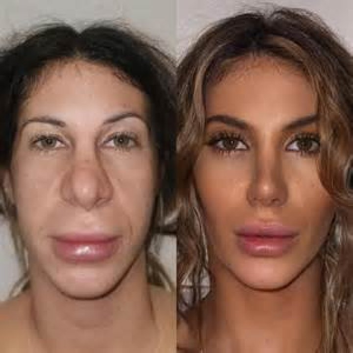 A Visual Guide To Plastic Surgery Transformations
