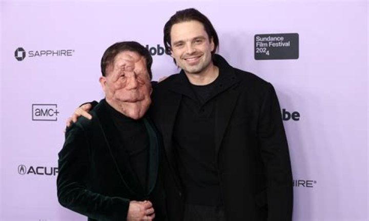Adam Pearson's Wife: Exploring His Life and Relationships