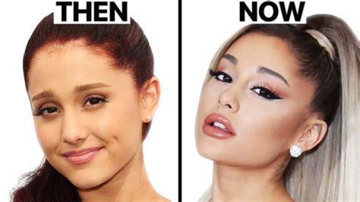 Ariana Grande's Eye Surgery And Its Profound Implications