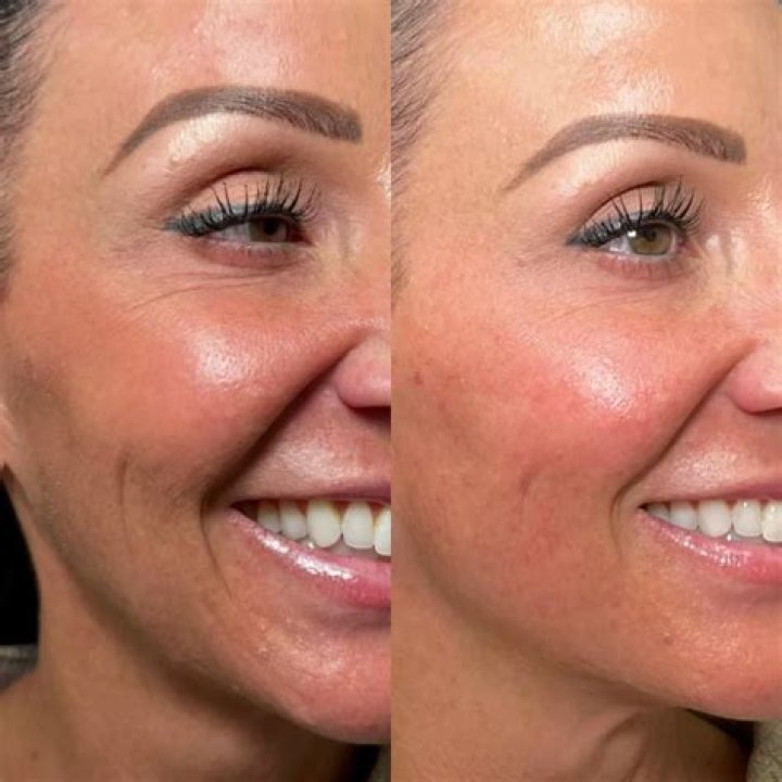 Before And After, Cost, And More