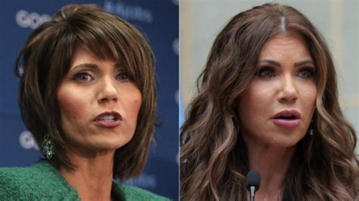 Before And After Her Alleged Surgery, Miracle Watt, 25!