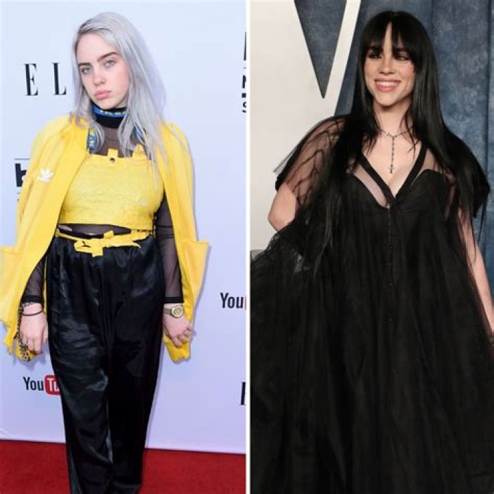 Billie Eilish Breast Reduction: A Journey Towards Self-Acceptance