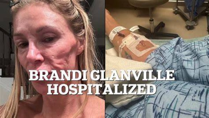 Brandi Glanville in Hospital for Stress-Induced Angioedema After Face Blew Up Like a Basketball (Exc