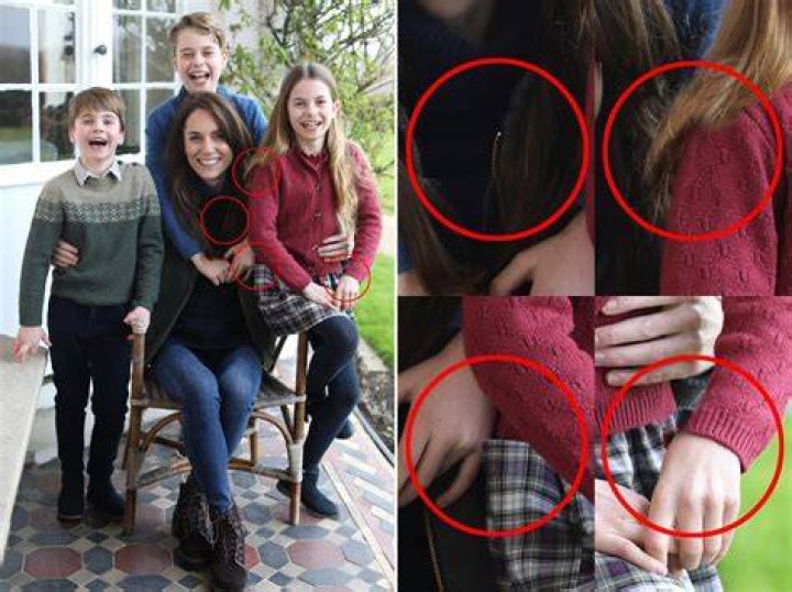 Did Claudia Jessie Get Eye Surgery? Everything To Know About Her Health Condition ·