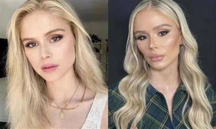 Did Erin Moriarty's Nose Job Transform Her Face?