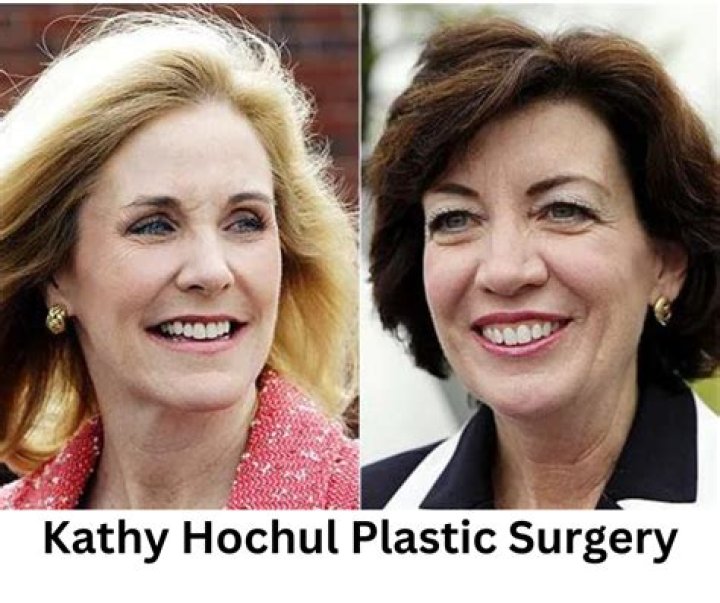 Did Kathy Hochul Do Plastic Surgery On Her Face? Before And After Pictures Of The Governor