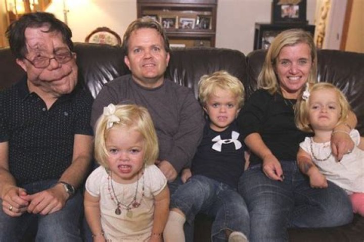 Is Adam Pearson Married? Exploring the Life of a Remarkable Individual