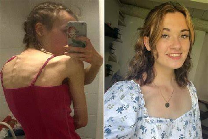Is Tallulah Willis Skinny Due To Anorexia Illness Weight Loss And Health Update |
