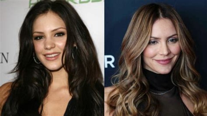 Katharine McPhee Breast Augmentation Plastic Surgery Before and After