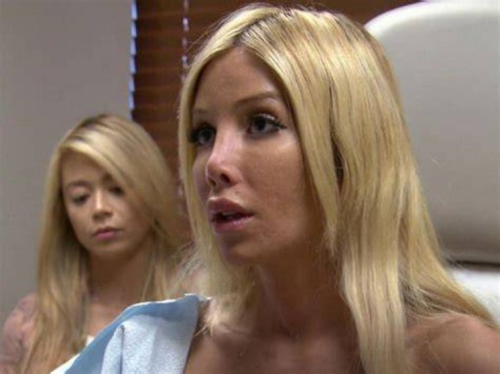 Kimber James Talks Multiple Plastic Surgeries!
