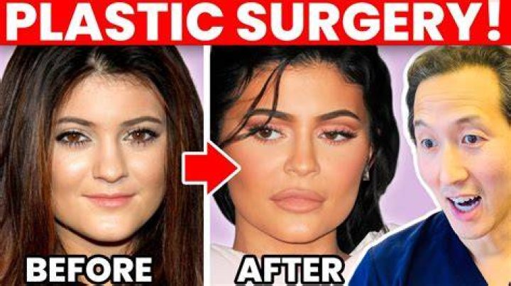 Mimi Keene Plastic Surgery And Bikini Pictures, Meet Her On Instagram