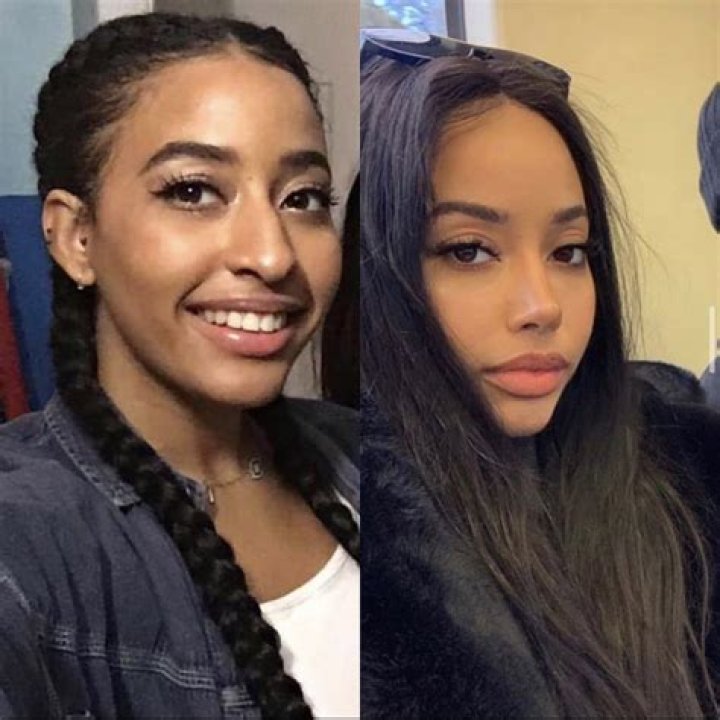Moriah's Nose Job Transformation: Before and After