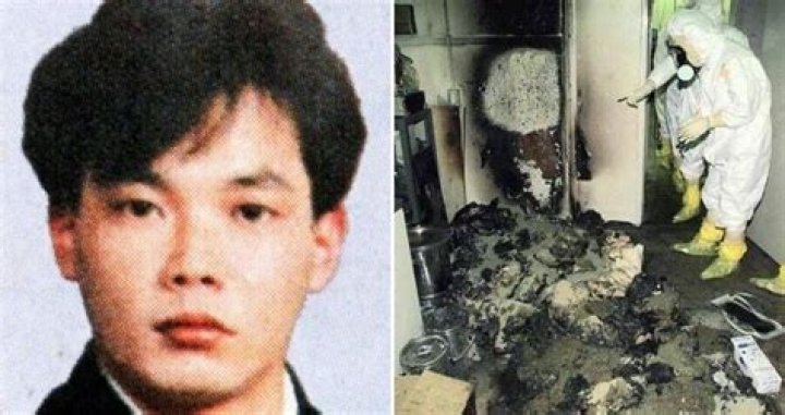 Real Photos Of Japanese Nuclear Plant Worker Kept Alive Melted for 83 Days
