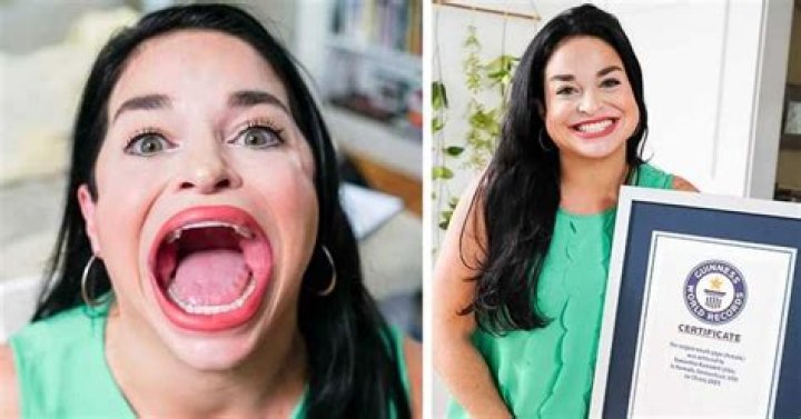 Samantha Ramsdell Meet Woman With Largest Mouth