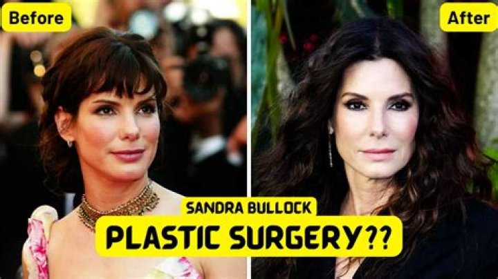 Sandra Bullock's Plastic Surgery Journey Explored