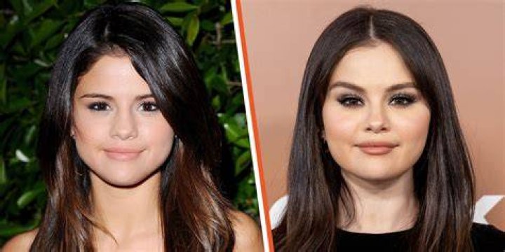Selena Gomez Boob Job Report