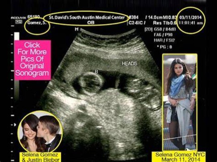 Selena Gomez Pregnant With Justin Bieber Baby
