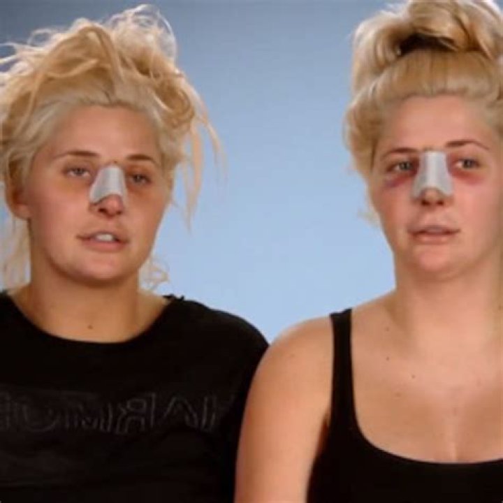 Seven years on, Botched's Shannon twins are still flaunting their dream bodies ·