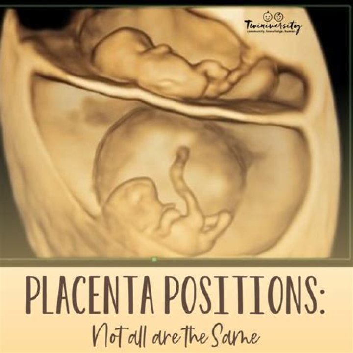 Should US mothers be paid to donate placentas?
