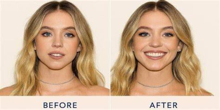 Sydney Sweeney Weight Loss Before And After: Tips and Transformation