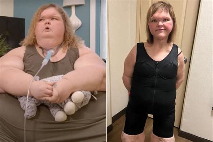Tammy's Weight Loss Journey Insights And Discoveries