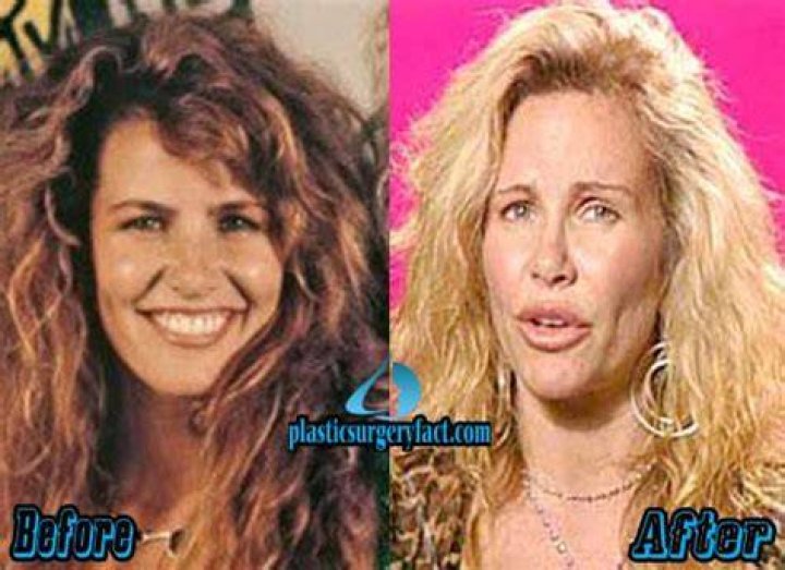 Tawny Kitaen Said She Got Plastic Surgery Due to Insecurities ·