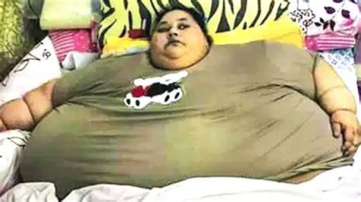 The Fattest Person in the World