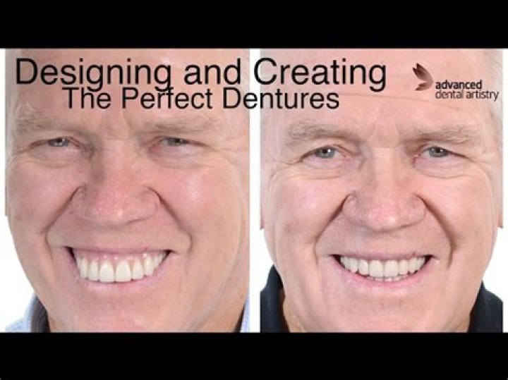 Unlocking The Secrets Of Tanya Tucker Dentures