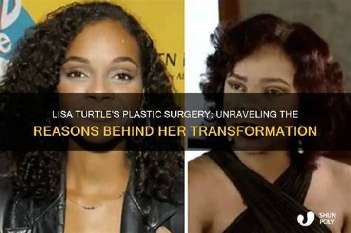Unraveling The Reasons Behind Her Iconic Transformation