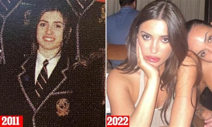 Unveiling Bianca Censori's Plastic Surgery Journey: Discoveries And Insights