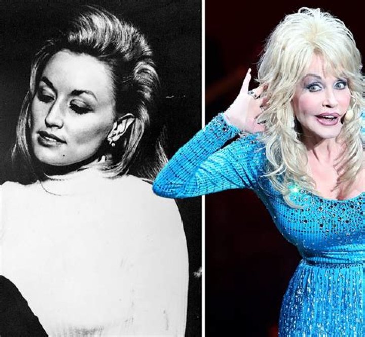 Unveiling Dolly Parton's Natural Beauty: Authenticity Beyond The Wig