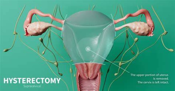 Unveiling The Truth About Princess Kate's Hysterectomy: A Journey Of Discovery