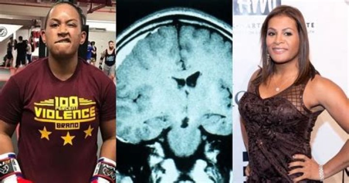 When Transgender Fighter Fallon Fox Broke Her